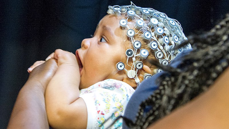 Recherche - Institut Robert-Debré du Cerveau de l’Enfant